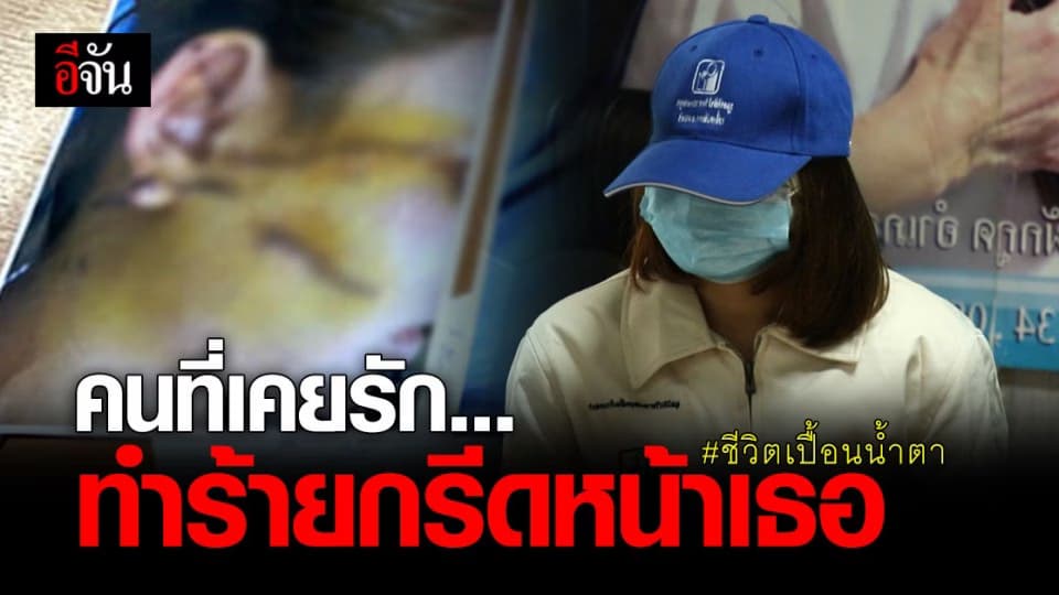 เรื่องเล่าสุดเศร้า จากปาก สาววัย 25 ถูก ผัวโหด ใช้ คัตเตอร์กรีดหน้า เย็บเกือบ 100 เข็ม