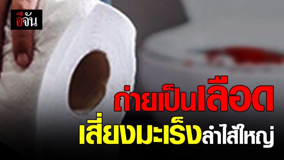 เตือนแล้วนะ! ขับถ่ายเป็นเลือด เสี่ยงเป็นโรคมะเร็งลำไส้ใหญ่