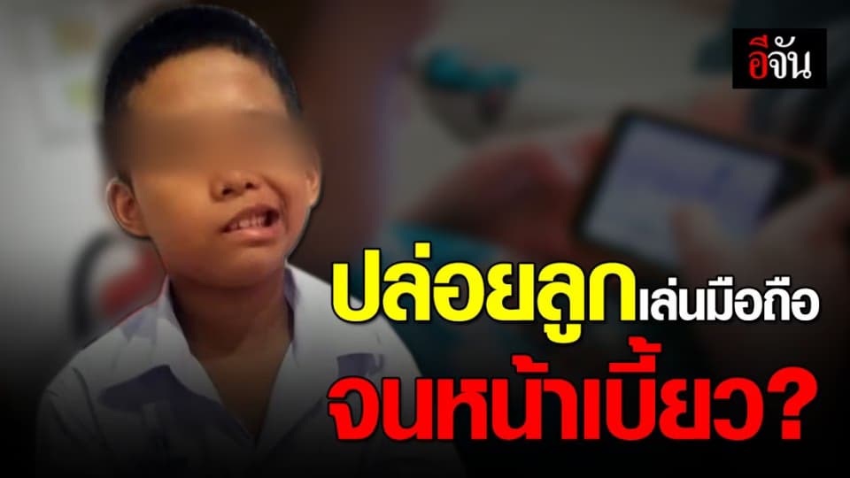 แพทย์เตือนปล่อยลูกเล่นมือถือนานๆ เสี่ยงหน้าเบี้ยวครึ่งซีก