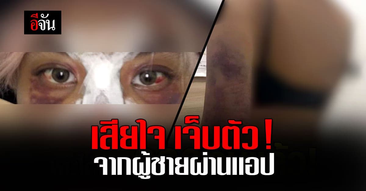 สาว 26 ร้อง ปวีณา คบหนุ่มผ่านแอปฯหาคู่ ทำร้ายร่างกาย ไม่เว้นวัน