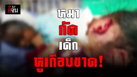 หมากัดเด็กอีกแล้ว คราวนี้หูเกือบขาด!