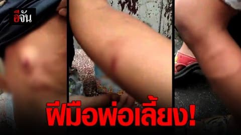ร้อง “ปวีณา” เด็ก 4 ขวบ ถูกพ่อเลี้ยงทำร้ายแผลทั่วตัว
