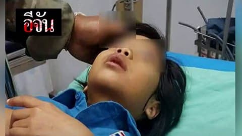 น้องถูกถีบเกือบสลบ แต่ครูกลับนิ่งเฉย?