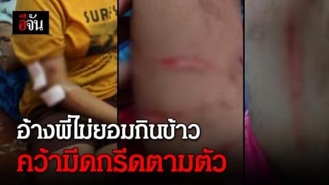 ลูกเพื่อนบ้านวัย 12 ใช้มีดกรีดเด็กหญิงตาบอด-พิการทางสมอง แผลทั่วตัว