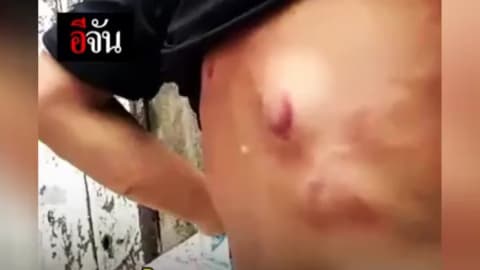 พ่อเลี้ยงใจโหด ตีเด็ก 4 ขวบระบมไปทั้งตัว