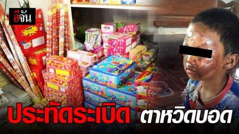 เด็กน้อยประทัดระเบิดใส่หน้า ตาหวิดบอด