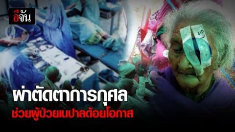 โครงการผ่าตัดตาต้อกระจกถวายเป็นพระราชกุศล ช่วยผู้ป่วยเนปาลด้อยโอกาส