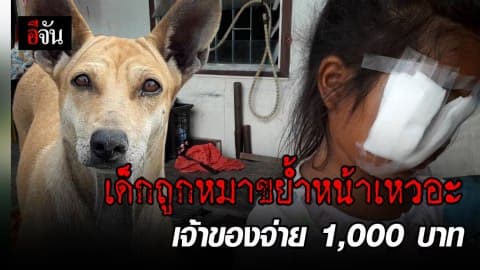 แม่โวยหมากัดลูก ขย้ำจนหน้าเหวอะ เย็บ 5 เข็ม – เจ้าของจ่ายแค่ 1,000 … แบบนี้ก็ได้เหรอ ?