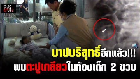 บาปบริสุทธิ์อีกแล้ว!!! พบตะปูเกลียวในท้องเด็ก 2 ขวบ
