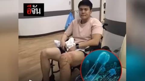 น้ำส้มสายชูดับพิษแมงกระพรุน?