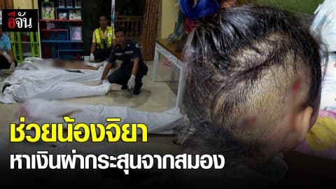 ช่วยน้องจิยา หาเงินผ่ากระสุนจากสมอง