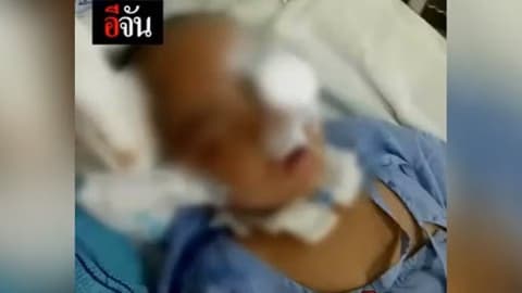 เด็กหญิง 3 ขวบคล้ายเป็นเจ้าหญิงนิทรา เหตุเพราะถูกพ่อแม่ทำร้าย