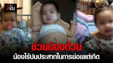 ช่วยน้องด้วย น้องไร้ปมประสาทในการย่อยแต่เกิด