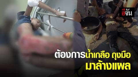 หนุ่มร้องเพจอีจัน รถ จยย.ล้ม รถสิบล้อเหยียบซ้ำ ถูกตัดขา ต้องการน้ำเกลือ ถุงมือ ล้างแผล