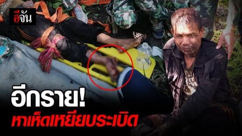 ชาวบ้านเคราะห์ร้ายรายที่2 เข้าป่าหวังหาเห็ด แต่เหยียบใส่ระเบิด หวิดขาขาด