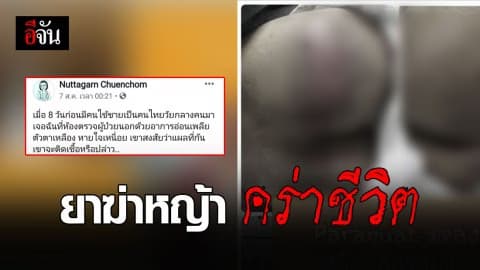 หมอโพสต์อุทาหรณ์คนไข้สะพายถังยาฆ่าหญ้า รั่วรดหลัง-ก้น ดับ