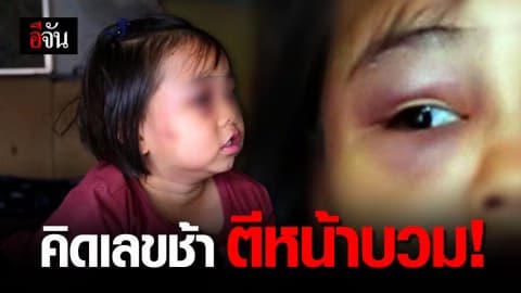 ครูใช้ไม้ตีหัว ด.ญ. 7 ขวบ เพราะคิดเลขช้า