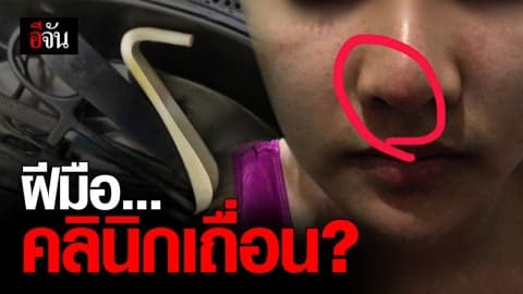 สาวแฉคลินิกศัลฯ แห่งหนึ่ง อ้าง ปลอมตั้งแต่เจ้าของ ยันโบท็อกซ์