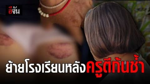 ออกหมายเรียกครูตีเด็กก้นช้ำ เพราะทำเวรไม่สะอาด