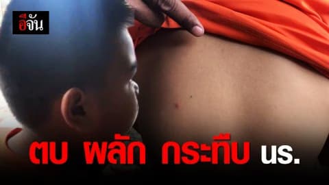 แม่รับไม่ได้! ลูกชายโดนตบหน้า เพราะทำโทรศัพท์ครูตก