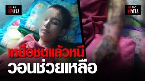 ไร้การเยียวยาจากคู่กรณี! เหยื่อรถชน ไฟคลอก แผลติดเชื้อ วอนช่วย