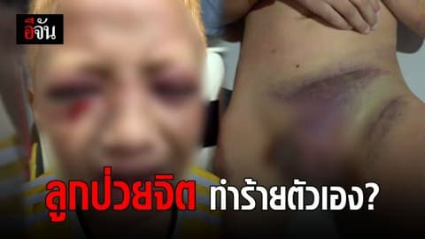 ด.ช.10 ขวบ แผลทั่วร่าง พ่อแม่อ้าง ลูกป่วยจิต ทำร้ายตัวเอง