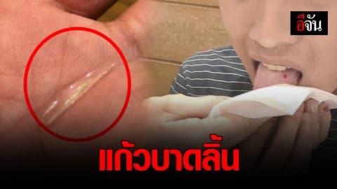 พ่อโวย! ลูกชายกินข้าวในร้านอาหารห้างดัง ถูกเศษแก้วในอาหารบาดลิ้น