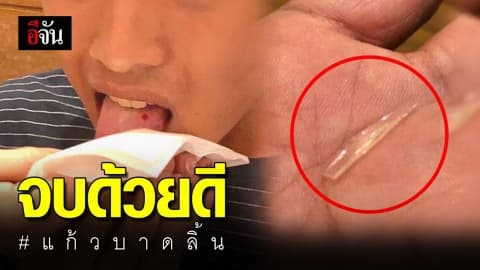 จบด้วยดี พ่อแจงร้านอาหารรับผิดชอบแล้ว หลังลูกชายถูกเศษแก้วในอาหารบาดลิ้น