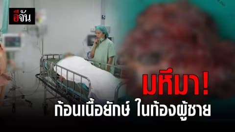 หมอผงะ! ผ่าท้องคนไข้ชาย เจอก้อนเนื้อชิ้นยักษ์ หนักเกือบ 6 กก.