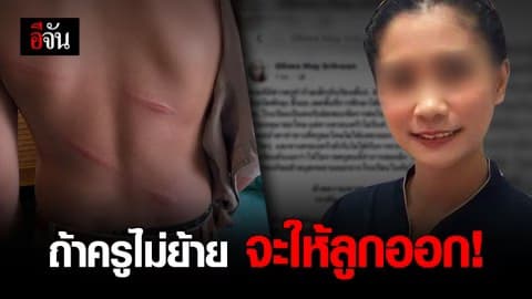 ครอบครัว ด.ช. ถูกครูตีอ่วม ไม่รับคำขอโทษครู