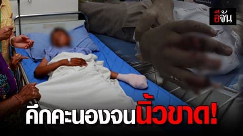 เด็ก 12 ขวบ ทำประทัดดัดแปลง พลาดระเบิดคามือ