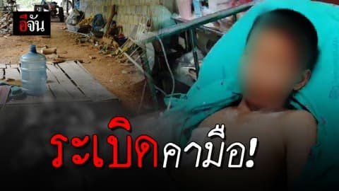 เด็ก 11 ใช้ค้อนทุบประทัด พลาดระเบิดคามือ