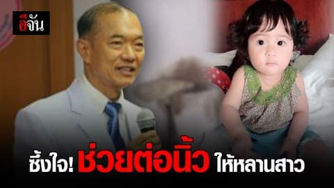 ซึ้งใจ หนุ่มโพสต์ขอบคุณหมอ ช่วยต่อนิ้วให้หลานสาว