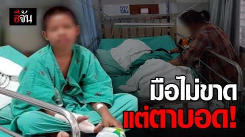 อีกแล้ว! ประทัดปิงปองระเบิดเข้าตาเด็ก 11 ขวบ ตาบอด