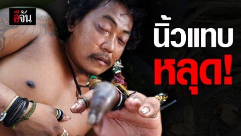 นิ้วบวมเป่ง รอการช่วยเหลือ