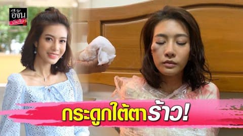 “ไอซ์” น้ำตาร่วงเจ็บหนัก เกิดอุบัติเหตุกลางกอง