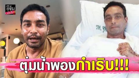 “เมฆ วินัย” โรคตุ่มน้ำพองกำเริบ ยอมรับผิดเองใช้ชีวิตประมาท