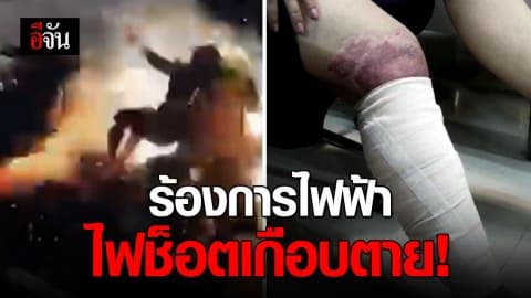 ไฟช็อต สาววัย 38 ปี ค่ารักษาพยาบาลเหยียบล้าน กฟภ. รับ ชดใช้ค่าเสียหายทั้งหมด