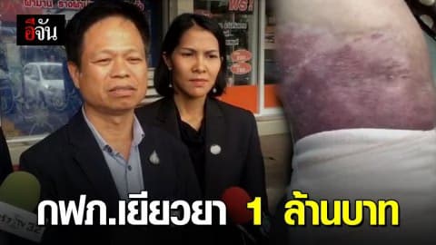 กฟภ.มอบเงิน 1 ล้านบาท เยียวยาสาวถูกไฟช็อต