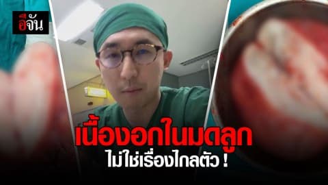 แพทย์แนะรีบเช็ค เนื้องอก 20 ซม. ในมดลูกไม่ใช่เรื่องไกลตัว