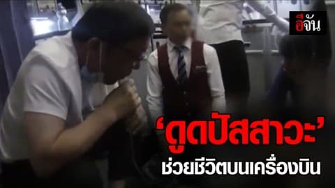 หมอจีนใช้ปาก ‘ดูดปัสสาวะ’ ช่วยชีวิตชายชราเสี่ยงตายกลางเที่ยวบิน