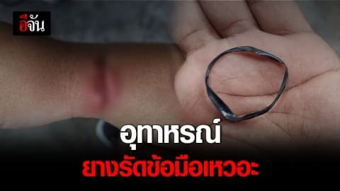 แม่ใจหาย! ยางรัดข้อมือลูก บาดลึก