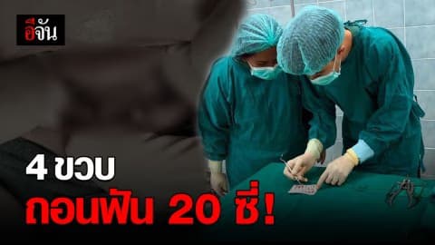 หมอฟันสุดสงสาร หลังต้องถอนฟันเด็ก 4 ขวบ 20 ซี่