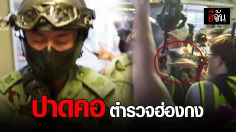 ไม่เหมือนเดิมอีกต่อไป! ตำรวจฮ่องกงพร้อมภรรยาเปิดใจ หลังถูกปาดคอยาว 5 เซนติเมตร ลึกถึงเส้นประสาท