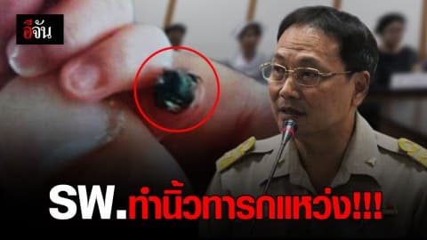 รพ.ชดใช้ 2 แสน พร้อมศัลยกรรมตกแต่งให้ หลังพลาดทำนิ้วทารกแหว่ง