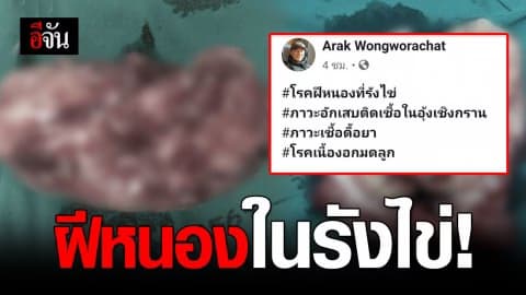 เตือนผู้หญิง ปวดท้องน้อยบ่อยๆ  ระวังฝีหนองในรังไข่!