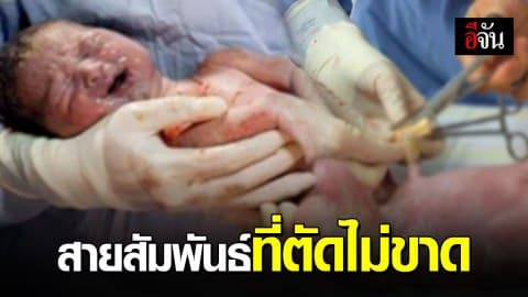 แพทย์เขียนประสบการณ์ในห้องคลอด กับวินาทีทำให้ฉุกคิด