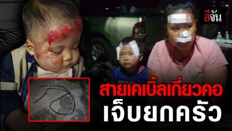 ใครจะรับผิดชอบ! สายเคเบิ้ลเกี่ยวคอ จยย.ล้ม เจ็บยกครัว