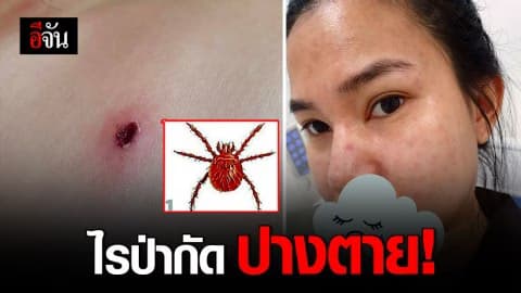 สาวโพสต์เตือน เที่ยวเขา โดนไรป่ากัด แทบเอาชีวิตไม่รอด