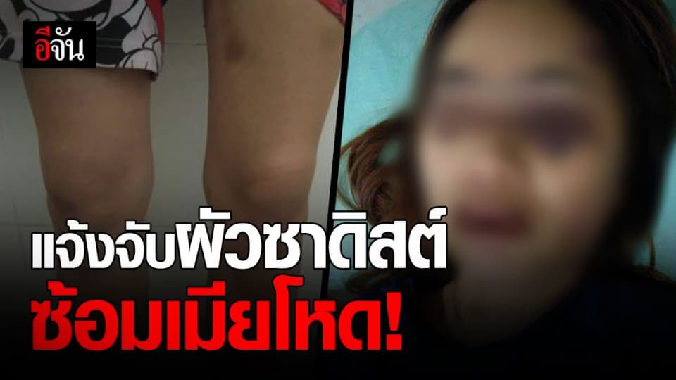 สาว 35 ร้องปวีณา แจ้งจับ ผัวซาดิสต์ หลังถูก ซ้อมสุดโหด